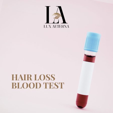 Hair Loss Blood Test